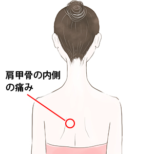 肩甲骨の内側の痛み